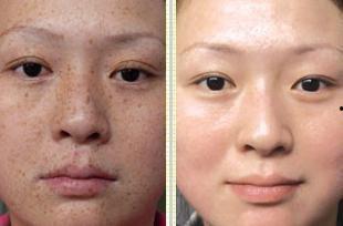 斑解内部爆料最新,揭秘行业背后惊人内幕